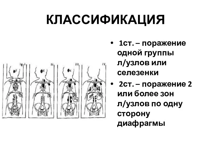 КЛАССИФИКАЦИЯ 1ст. – поражение одной группы л/узлов или селезенки 2ст. – поражение