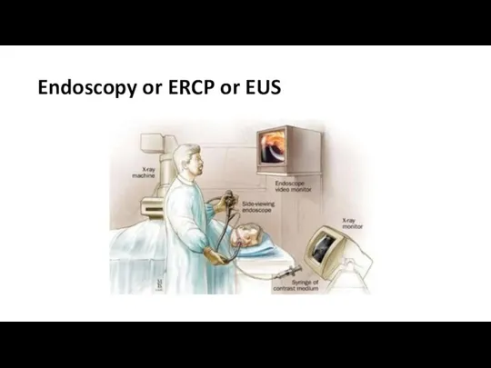 Endoscopy or ERCP or EUS