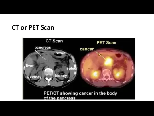 CT or PET Scan