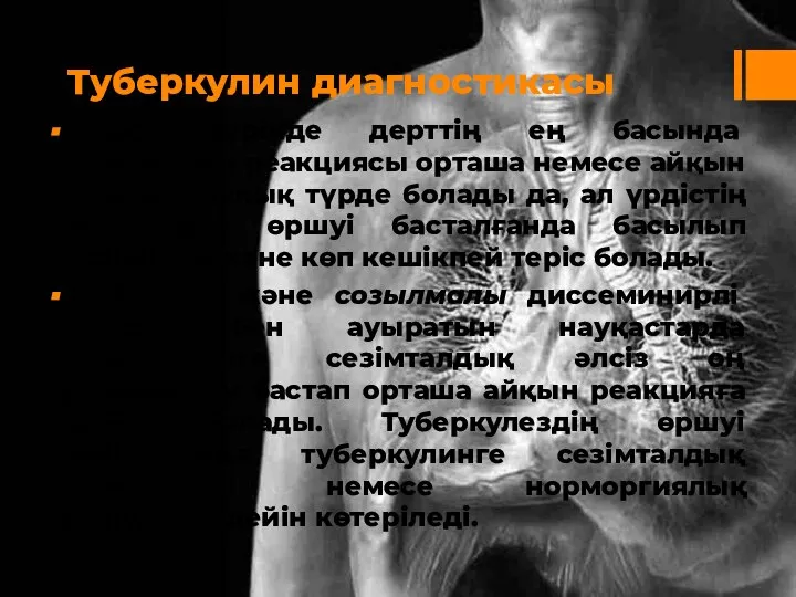 Туберкулин диагностикасы Жедел түрінде дерттің ең басында туберкулин реакциясы орташа немесе айқын