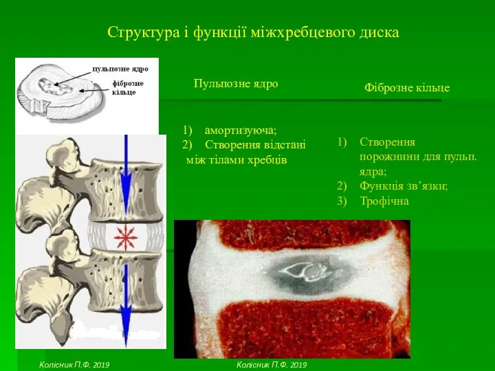 Структура і функції міжхребцевого диска Пульпозне ядро амортизуюча; Створення відстані між тілами