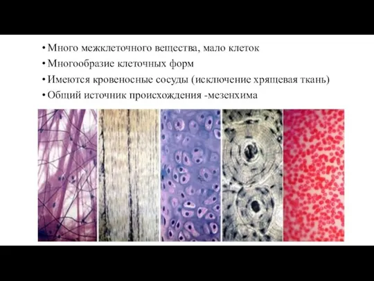 Много межклеточного вещества, мало клеток Многообразие клеточных форм Имеются кровеносные сосуды (исключение