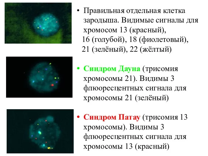 Правильная отдельная клетка зародыша. Видимые сигналы для хромосом 13 (красный), 16 (голубой),