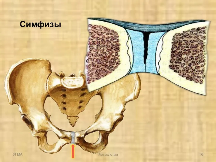 Симфизы УГМА Артрология