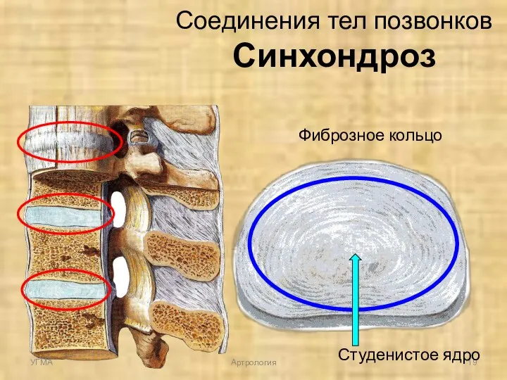 Соединения тел позвонков Синхондроз Фиброзное кольцо Студенистое ядро УГМА Артрология