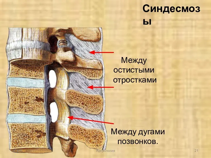 Синдесмозы Между остистыми отростками Между дугами позвонков. УГМА Артрология