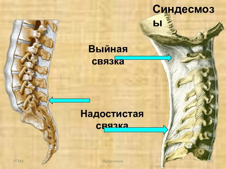 Надостистая связка Выйная связка Синдесмозы УГМА Артрология