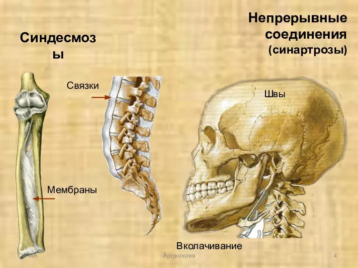 Непрерывные соединения (синартрозы) Синдесмозы Мембраны Швы Вколачивание Связки УГМА Артрология