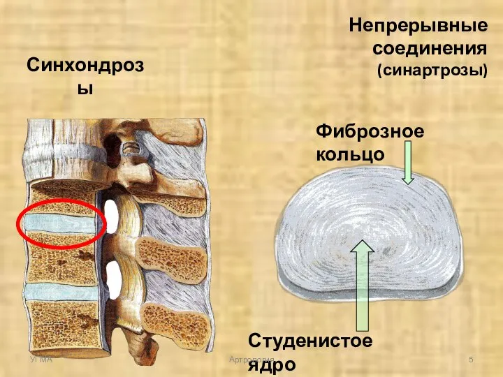 Фиброзное кольцо Студенистое ядро Синхондрозы Непрерывные соединения (синартрозы) УГМА Артрология