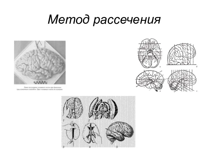 Метод рассечения