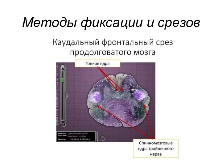 Методы фиксации и срезов