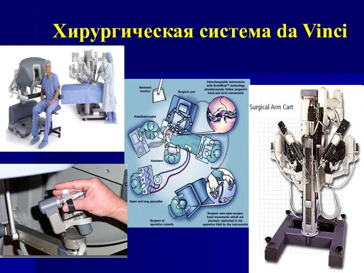Хирургическая система da Vinci