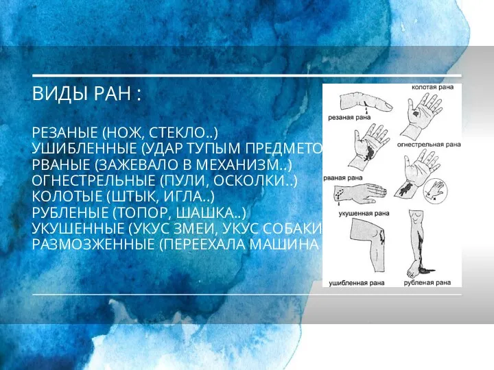 ВИДЫ РАН : РЕЗАНЫЕ (НОЖ, СТЕКЛО..) УШИБЛЕННЫЕ (УДАР ТУПЫМ ПРЕДМЕТОМ..) РВАНЫЕ (ЗАЖЕВАЛО