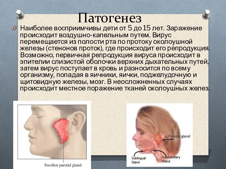 Патогенез Наиболее восприимчивы дети от 5 до 15 лет. Заражение происходит воздушно-капельным