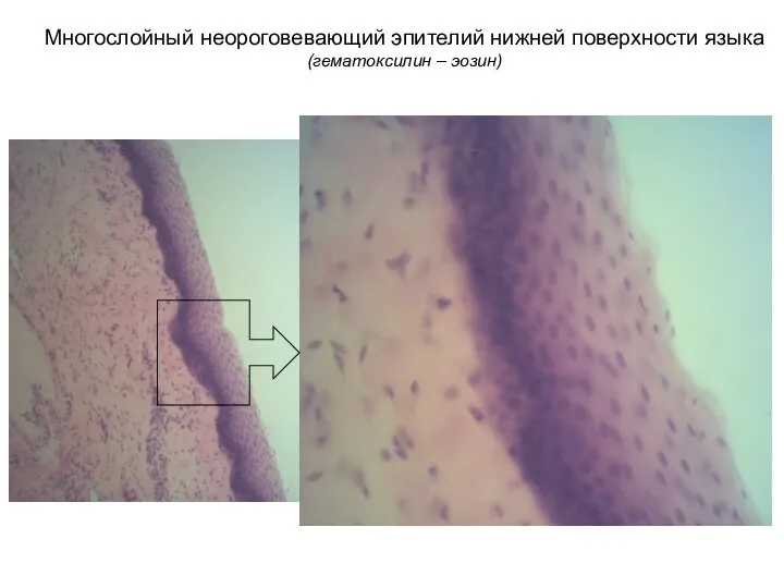 Многослойный неороговевающий эпителий нижней поверхности языка (гематоксилин – эозин)