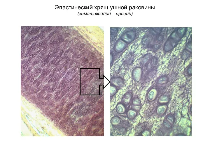 Эластический хрящ ушной раковины (гематоксилин – орсеин)