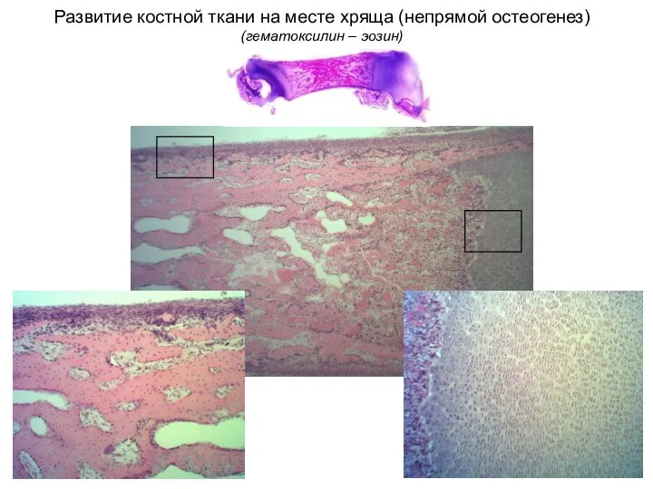 Развитие костной ткани на месте хряща (непрямой остеогенез) (гематоксилин – эозин)