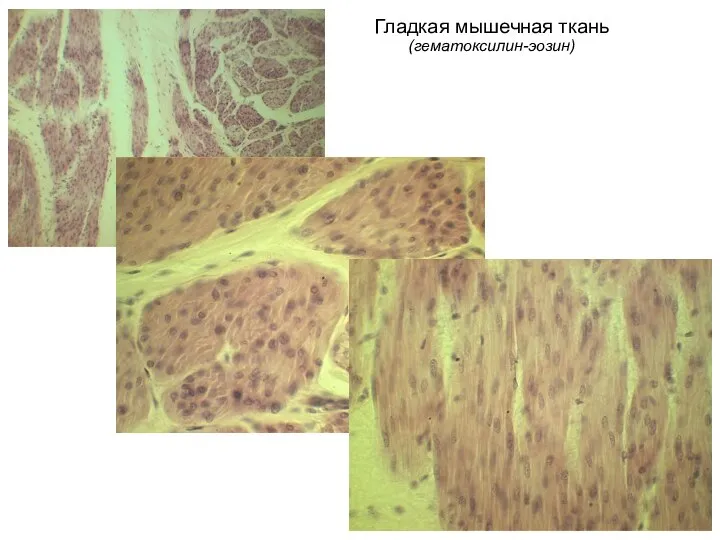 Гладкая мышечная ткань (гематоксилин-эозин)