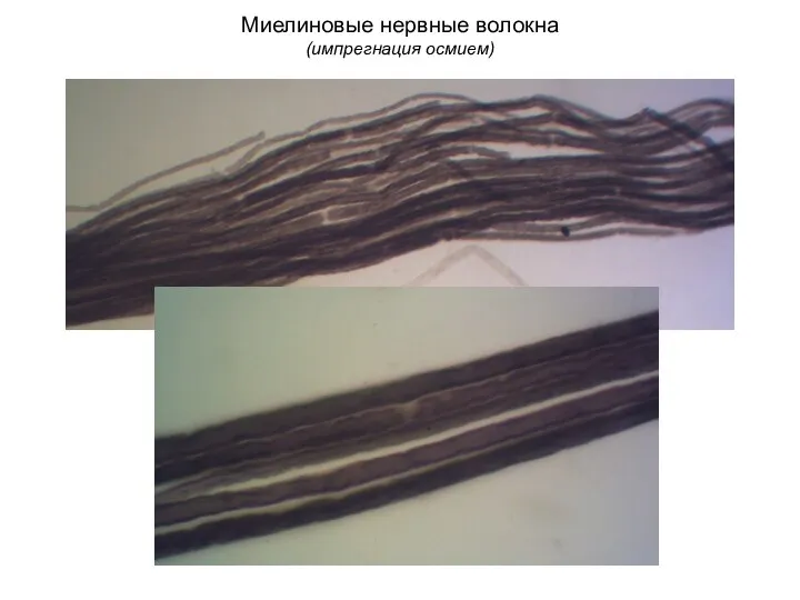 Миелиновые нервные волокна (импрегнация осмием)