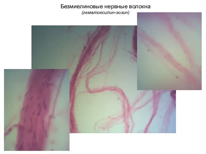 Безмиелиновые нервные волокна (гематоксилин-эозин)