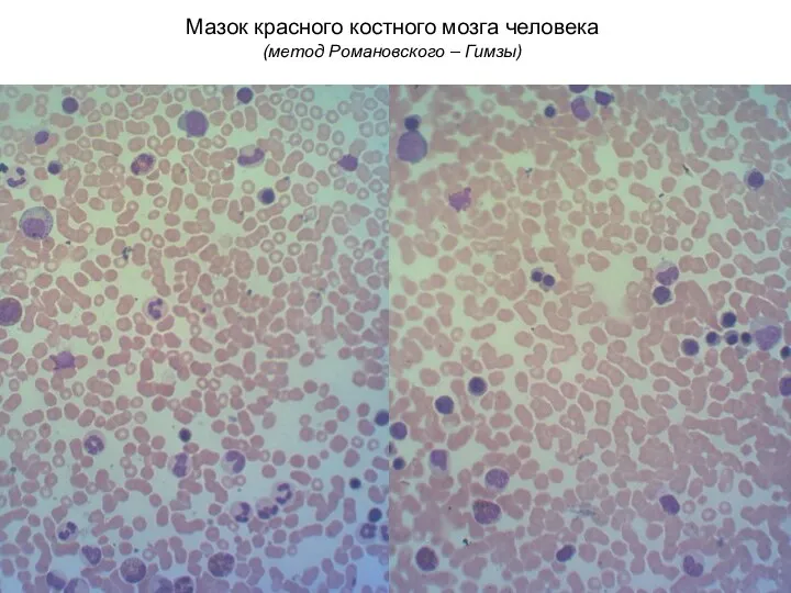 Мазок красного костного мозга человека (метод Романовского – Гимзы)