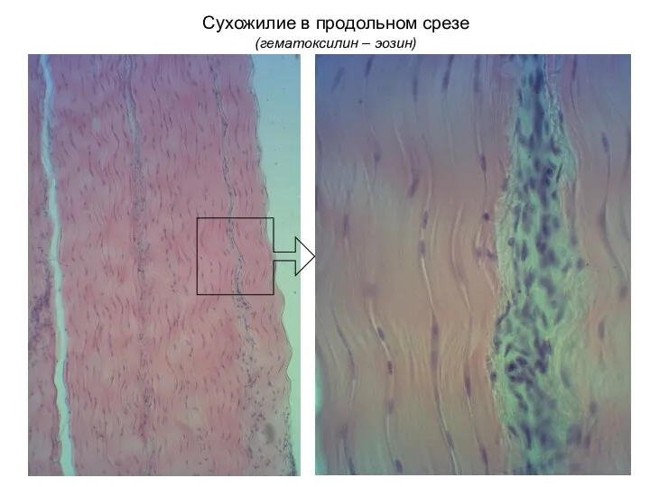 Сухожилие в продольном срезе (гематоксилин – эозин)