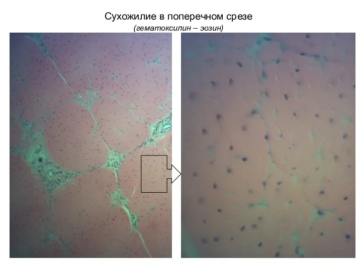 Сухожилие в поперечном срезе (гематоксилин – эозин)