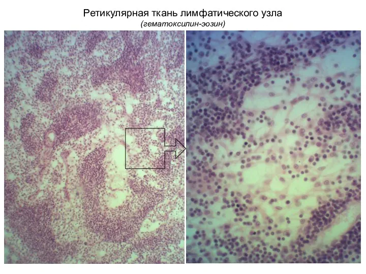 Ретикулярная ткань лимфатического узла (гематоксилин-эозин)
