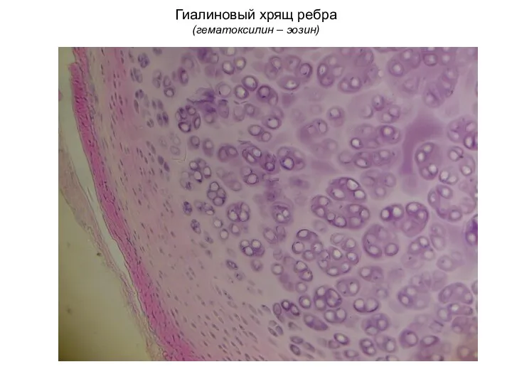 Гиалиновый хрящ ребра (гематоксилин – эозин)