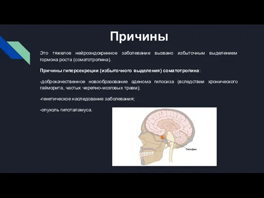 Причины Это тяжелое нейроэндокринное заболевание вызвано избыточным выделением гормона роста (соматотропина). Причины