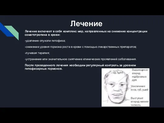 Лечение Лечение включает в себя комплекс мер, направленных на снижение концентрации соматотропина