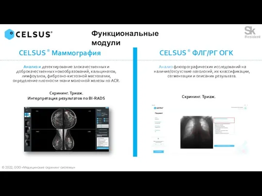 Анализ и детектирование злокачественных и доброкачественных новообразований, кальцинатов, лимфоузлов, фиброзно-кистозной мастопатии, определение