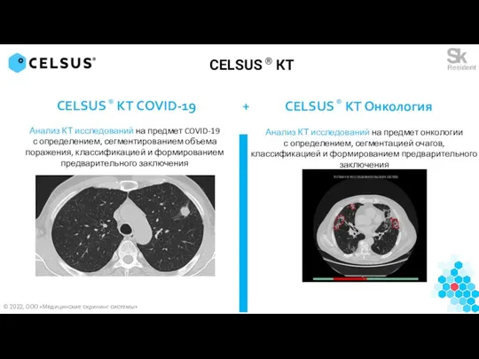 CELSUS ® КТ CELSUS ® КТ COVID-19 + Анализ КТ исследований на