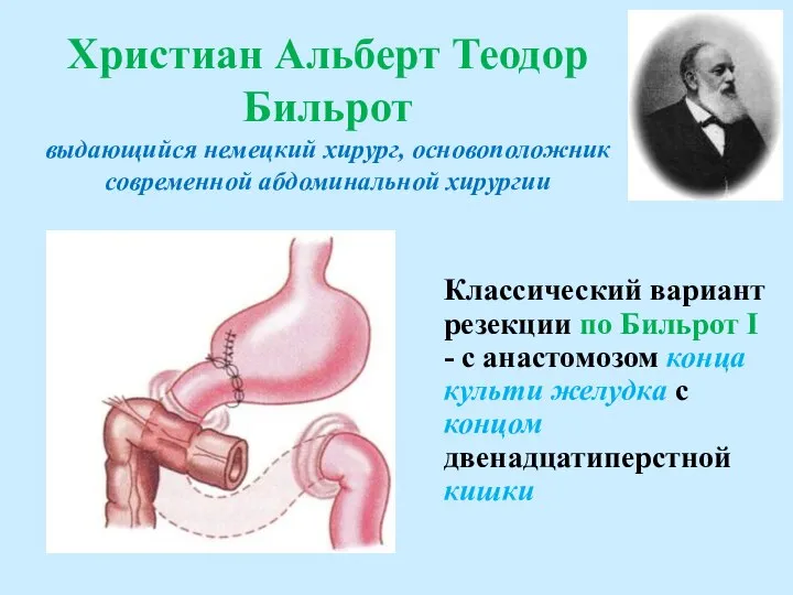 Христиан Альберт Теодор Бильрот выдающийся немецкий хирург, основоположник современной абдоминальной хирургии Классический