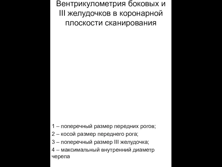 Вентрикулометрия боковых и III желудочков в коронарной плоскости сканирования 1 – поперечный