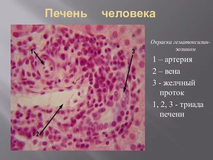 Печень человека Окраска гематоксилин-эозином 1 – артерия 2 – вена 3 -