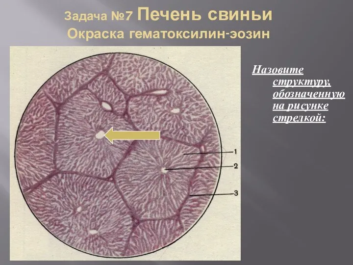 Задача №7 Печень свиньи Окраска гематоксилин-эозин Назовите структуру, обозначенную на рисунке стрелкой: