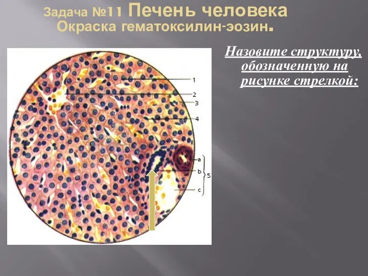 Задача №11 Печень человека Окраска гематоксилин-эозин. Назовите структуру, обозначенную на рисунке стрелкой: