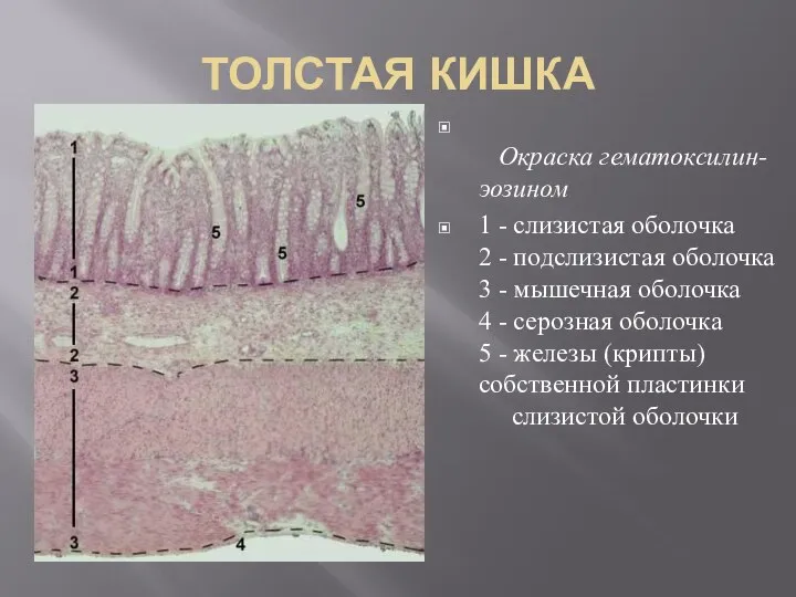 ТОЛСТАЯ КИШКА Окраска гематоксилин-эозином 1 - слизистая оболочка 2 - подслизистая оболочка