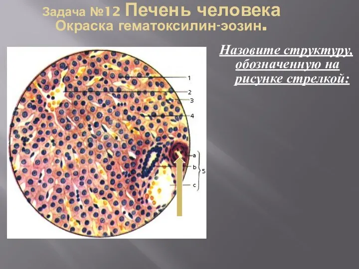 Задача №12 Печень человека Окраска гематоксилин-эозин. Назовите структуру, обозначенную на рисунке стрелкой: