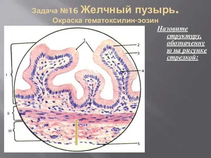 Задача №16 Желчный пузырь. Окраска гематоксилин-эозин Назовите структуру, обозначенную на рисунке стрелкой: