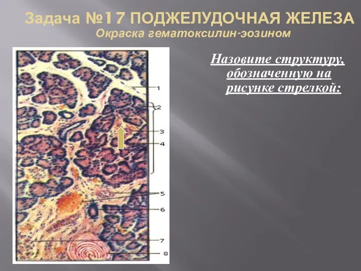 Задача №17 ПОДЖЕЛУДОЧНАЯ ЖЕЛЕЗА Окраска гематоксилин-эозином Назовите структуру, обозначенную на рисунке стрелкой: