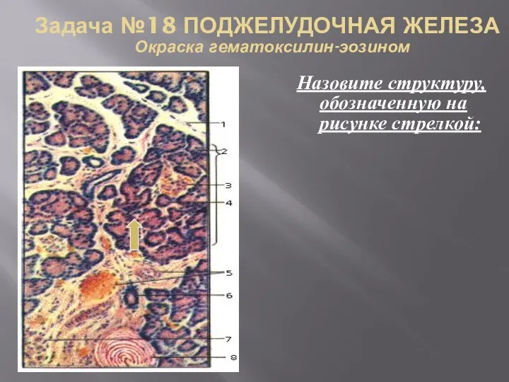 Задача №18 ПОДЖЕЛУДОЧНАЯ ЖЕЛЕЗА Окраска гематоксилин-эозином Назовите структуру, обозначенную на рисунке стрелкой: