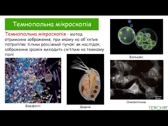 Водорості Онкоклітини Темнопольна мікроскопія Темнопольна мікроскопія - метод отримання зображення, при якому