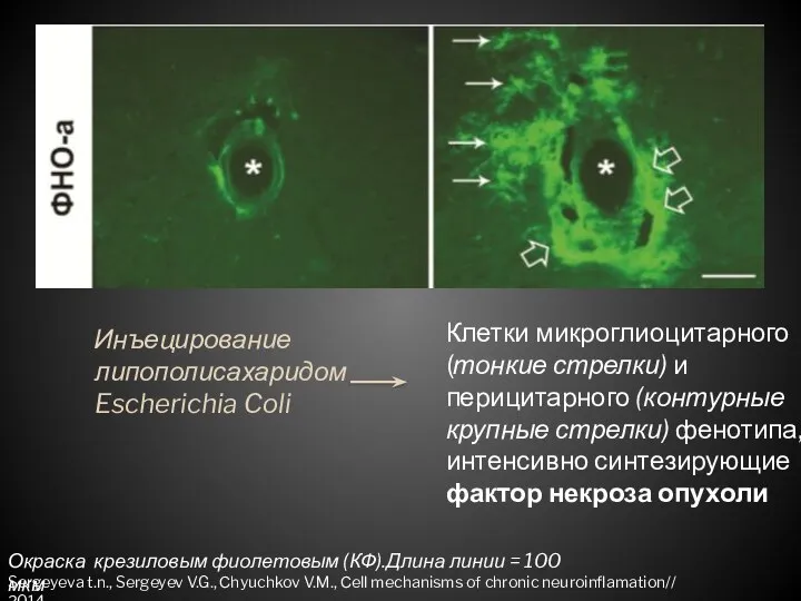Клетки микроглиоцитарного (тонкие стрелки) и перицитарного (контурные крупные стрелки) фенотипа, интенсивно синтезирующие