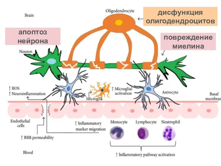 дисфункция олигодендроцитов повреждение миелина апоптоз нейрона