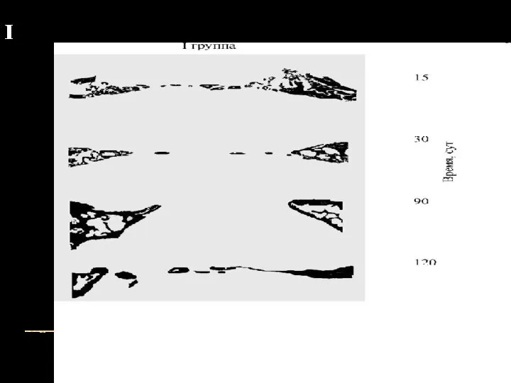 I1-КОНТРОЛЬНАЯ ГРУППА.