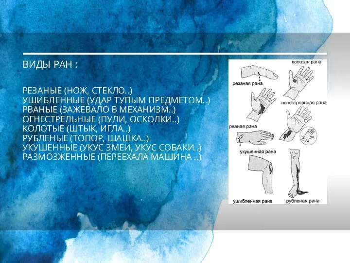 ВИДЫ РАН : РЕЗАНЫЕ (НОЖ, СТЕКЛО..) УШИБЛЕННЫЕ (УДАР ТУПЫМ ПРЕДМЕТОМ..) РВАНЫЕ (ЗАЖЕВАЛО