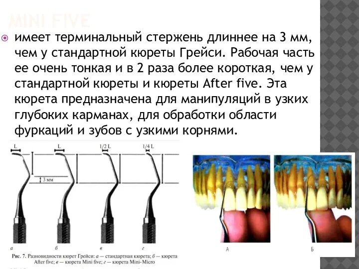 MINI FIVE имеет терминальный стержень длиннее на 3 мм, чем у стандартной