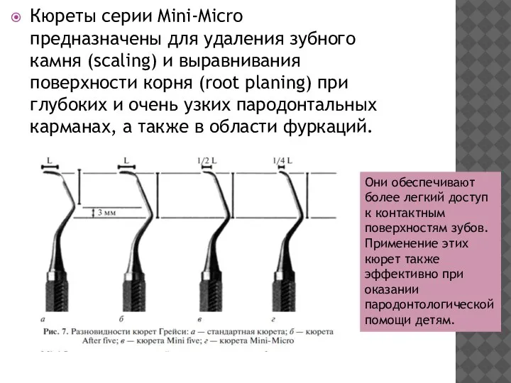 Кюреты серии Mini-Micro предназначены для удаления зубного камня (scaling) и выравнивания поверхности